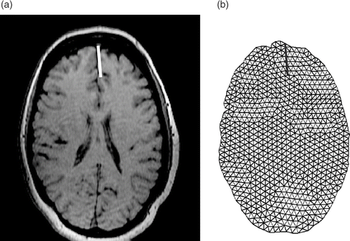 Figure 8. (a) The first iMR image with our estimate of the location of the cut. (b) The mesh created from the brain region of the first iMR image and cut; the cut defines intersections with the mesh.