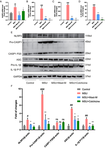 Figure 6 Mast-M inhibits NLRP3 inflammasome activation in a mouse model of gout. QPCR analysis of (A) NLRP3, (B) Caspase 1, (C) ASC, and (D) IL-1β in the homogenate of paw tissue from mice. (E and F) Western blot analysis of NLRP3, pro-Caspase 1, Caspase 1 P20, ASC, pro-IL-1β, and IL-1β in the homogenate of paw tissue from mice. Data were expressed as mean ± SEM (n=3). #p<0.05, ##p<0.01, ###p<0.001 vs Control group; *p<0.05, **p<0.01, ***p<0.001 vs MSU group.