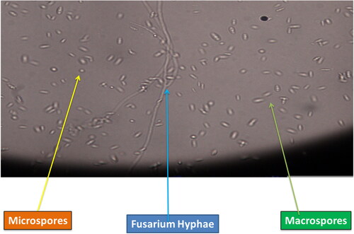 Figure 2. Pathogen showing microspores and macrospores.