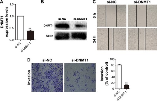 Figure 4 Knockdown of DNMT1 significantly repressed the invasion and migration of NPC cells. (A) Efficiency of si-DNMT1 was determined by qRT-PCR (B) Western blot in CNE-2 cells. (C) Wound-healing assays indicated that knockdown of DNMT1 inhibited the migration capability of NPC cells. (D) Transwell assay showed that knockdown of DNMT1 inhibited invasion capability of NPC cells. **P<0.05 compared with control.