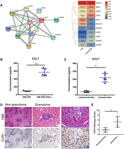 Figure 7 The expression levels of CCL7 and CCR1 in vitro and in vivo. (A) Network of CCL7 acquired from STRING database and the heatmap showing the average readout value of CCL7 and its related genes in LGCs. (B) Human CCL7 ELISA for LGC formation group (GM-CSF + IFN-γ for 7 day) (n=5) and GM-CSF-induced macrophage group (GM-CSF for 7 day) (n = 5). (C) CCL7 ELISA in the homogenate supernatant of lesional and non-lesioned skin tissue of leprosy patients (n = 3). (D and E) Immunohistochemical analysis of CCR1 expression in granuloma cells and non-granulomatous inflammatory cells in mycobacterial infectious diseases (n = 9). The rectangle with blue dotted border shows the magnification view. Scale bar, 200 μm. ***P < 0.001, **P < 0.01, *P < 0.05.