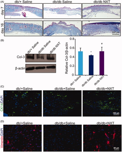 Figure 2. Effect of NXT on collagen deposition and ECM remoulding in diabetic wounds. (A) Masson’s trichrome staining wounds treated with NXT at day 7 and 16 post-injury. NXT increased collagen fibres in the wounds compared with saline. Collagen fibres were stained in blue. Scale bar = 500 μm. (B) Western blot of Col-3 and quantitative analysis of Col-3 at day 7 post-injury. (C) Immunofluorescence for CK14 at day 7 post-injury. Scale bar = 100 μm. (D) Immunofluorescence for vimentin at day 7 post-injury. Scale bar = 50 μm, and counterstained with DAPI. Results were presented as mean ± SD. *p < 0.05 vs. db/+ mice treated with saline, #p < 0.05 vs. db/db mice treated with saline. n = 3.