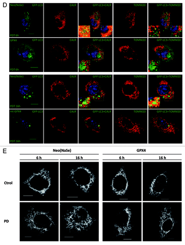 Figure 4D and E. Secondary ROS modulate organelle-specific autophagy. (D) Confocal microscopy images corresponding to the effect of antioxidants on the number of GFP-labeled autophagosomes detected at 6 and 16 h after Hyp-PD stress as well as the colocalization of the autophagosomes with ER- and mitochondria fragments. Calreticulin (CALR) antibody was labeled with the Texas Red fluorophore, whereas TOMM20 antibody with AlexaFluor 647; for clarity of the merged images, images corresponding to TOMM20 are shown in false color red. (E) Confocal microscopy images corresponding to the changes in mitochondrial morphology that accompany transition from reticulophagy to mitophagy in Neo(NaSe) cells and protection displayed by GPX4. Scale bar: 10 μm.