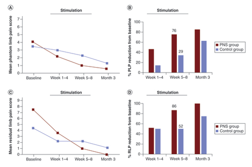 Figure 4. Average phantom limb pain and residual limb pain scores. (A) Group means and (B) percent reduction from baseline for average PLP scores. (C) Group means and (D) percent reduction from baseline for average RLP scores. Data are shown at postoperative baseline and mean of weeks 1–4, weeks 5–8 and at the 3-month follow-up visit. Stimulation was active in the PNS group for 8 weeks beginning after baseline.PLP: Phantom limb pain; PNS: Peripheral nerve stimulation; RLP: Residual limb pain.