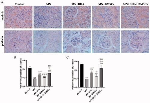 Figure 3. Effect of combination therapy with DHA and BMSCs on podocyte injury in MN mice. (A) Immunohistochemistry for nephrin and podocin (scale bar = 40 μm). (B) Positive nephrin expression. (C) Positive expression of podocin. Values are expressed as the mean ± SD, n = 5 per group. **p < .01 versus control group; ***p < .001 versus control group; ###p < .001 versus MN model group; @p < .05 versus MN + DHA group; @@p < .01 versus MN + DHA group; @@@p < .001 versus MN + DHA group; $$$p < .001 versus MN + BMSCs group.