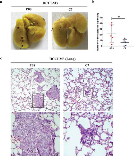 Figure 6. Effect of the C7 peptide on tumor metastasis in the orthotopic xenograft (OX) models.(a) Photographs of metastatic foci in the lungs of the PBS and C7 groups, C7: 10 mg/kg. (b) The statistical result of the number of metastatic foci in the lungs. (c) Representative photographs of H&E staining in the lungs of nude mice administered PBS or C7.