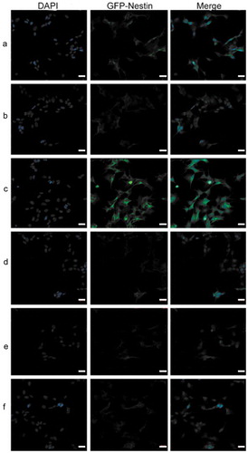 Figure 9. Immunofluorescent staining indicated that Nestin expression was remarkably enhanced in shRNA‑17A‑transfected cells, compared with that in pcDNA-17A‑transfected cells. (a) Normal SH-SY5Y cells; (b) negative control; (c) SH-SY5Y cells transfected with 17A shRNA; (d) scramble control; (e) SH-SY5Y cells transfected with pcDNA-17A; (f) cells transfected with pcDNA-control.Scale bar, 20 μm. Merged images were shown in each row. Nuclei were counterstained with DAPI (shown in blue).