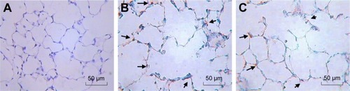 Figure 7 Apoptosis of lung tissue.