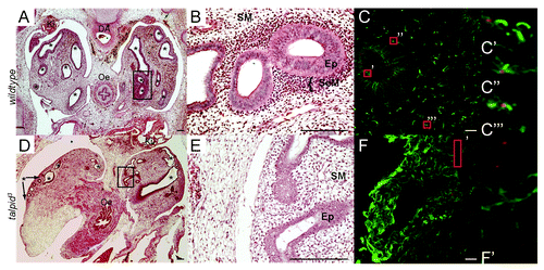 Figure 2. Lung development in the wt and talpid3 chicken. Haematoxylin and eosin staining E7 (A–E). IHC anti-acetylated tubulin (cilia axonemes;green) and anti- γtubulin (centrosomes;red) E10 (CandF). At E7 the epithelial mesobronchi of each lung has branched extensively throughout the wt lung mesenchyme (asterisks) (A). The more mature wt primary bronchi (circled area) (A andB) are surrounded by a condensation of SeM cells (B). Mesobronchi branching in the talpid3 lung is disturbed and differs between lungs within the same embryo (bronchi labeled with asterisk or arrow asterisk) (D), the epithelia is thinner and disorganized and no SeM condensations are seen (E). E10 wt lung exhibit cilia (C) on epithelia (C’), SeM (C”) and SM cells (C”’). E10 talpid3 lung, cilia do not project from centrosomes (red box) (F and F’) Magnification comparable between A–E, C–F.