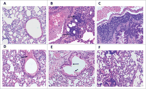 Figure 3. Histopathological findings in the lungs of immunized mice at 8 d post-challenge. Lung sections were stained with haematoxylin and Eosin and were examined using an Eclipse E-800 microscope (Nikon). Images were captured with a DXM1200C digital camera at a magnification power of 200X. Lung sections of mock-infected mice showed no infiltration of inflammatory cells – Score 0 (A). Lung sections of mice immunized with empty pPOE vector showed focal peribronchial leukocytic aggregations (arrows) – Score 2 (B), and those of FI-RSV immunized mice displayed massive infiltration of leukocytes with several layers of infiltrating cells and airway restriction – Score 3 (C). The lung sections of mice immunized with pPOE-F (D), pPOE-TF (E), and pPOE-FM2 (F) showed few leukocytes infiltrating in the peribronchiolar space and polypoids of the epithelial lining (arrows) – Score 1.