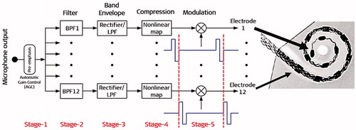 Figure 5. Block diagram of the CIS strategy. The pre-emphasis filter (Pre-emp)/automatic gain control attenuates strong components in the speech above 1.2 kHz. This filter is followed by multiple channels of processing, with each channel including stages of bandpass filtering (BPF), envelope detection, compression and modulation. The envelope detectors generally use a full-wave or half-wave rectifier (Rect.), followed by a lowpass filter (LPF). Carrier waveforms for two of the modulators are shown immediately below the two corresponding multiplier blocks (circle with an x mark). The outputs of the multipliers are directed to intracochlear electrodes (EL-1 to EL-12). The inset shows an x-ray image of the implanted electrode (in a cochlear model) to which the outputs of the speech processor are directed. Scheme created from Wilson et al. [Citation9].