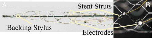 Figure 1. (a) Image of a generation 1 preclinical animal StentrodeTM showing the stent with electrodes (500µm diameter) and backing stylus. (b) Close-up of two electrodes (small – 500µm, large – 750 µm diameter) on the stent struts.