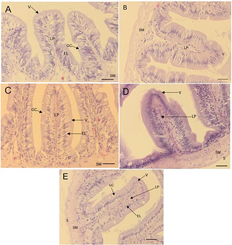 Figure 1. Micrographs of O. mossambicus fed Stinkbug meal as fishmeal replacement at different inclusion levels stained with H& E. A: diet D1 (0%), B: diet D2 (10%), C: diet D3 (30%), D: diets D4 (50%), E: diet D5 (70%). V: villi, LP: Lamina propria, GC: goblet cell, EL: epithelial layer, SM: Submucosa, S: Serosa. Scale bar: 20 µm.