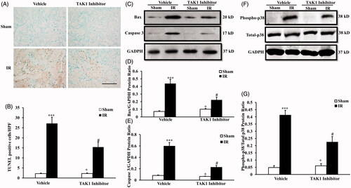 Figure 3. Inhibition of TAK1 decrease apoptotic cell death and p38 phosphorylation in kidney treated with IR. (A) Representative photomicrographs of kidney sections stained for apoptotic cells and counterstained with methyl green in kidneys. Scale bar: 50 μm. (B) Quantitative analysis of TUNEL-positive cells in the kidneys. ***p < .001 versus sham vehicle; +p < .05 versus TAK1 inhibitor IR; #p < .05 versus Vehicle IR. n = 6 in each group. HPF, high power field; TUNEL, terminal transferase dUTP nick-end labeling. (C) Representative western blots show Bax and cleaved caspase 3 protein levels in the kidneys after sham or IR. (D) Quantitative analysis of Bax protein levels in the kidneys. ***p < .001 versus sham vehicle; +p < .05 versus TAK1 inhibitor IR; #p < .05 versus vehicle IR. n = 6 in each group. (E) Quantitative analysis of cleaved caspase 3 protein levels in the kidneys. ***p < .001 versus sham vehicle; +p < .05 versus TAK1 inhibitor IR; #p < .05 versus Vehicle IR. n = 6 in each group. (F) Representative western blots showed phosphorylation levels of p38 in the kidneys after sham or IR. (G) Quantitative analysis of p38 phosphorylation in the kidneys after sham or IR. ***p < .001 versus sham vehicle; +p < .05 versus TAK1 inhibitor IR; #p < .05 versus vehicle IR. n = 6 in each group.