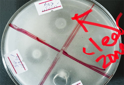 Figure 2. Growth of bacterial isolates on Pikovskaya medium. Bacterial isolates exhibit the formation of a clear zone around their colonies, indicating the ability to degrade the components present in Pikovskaya media.