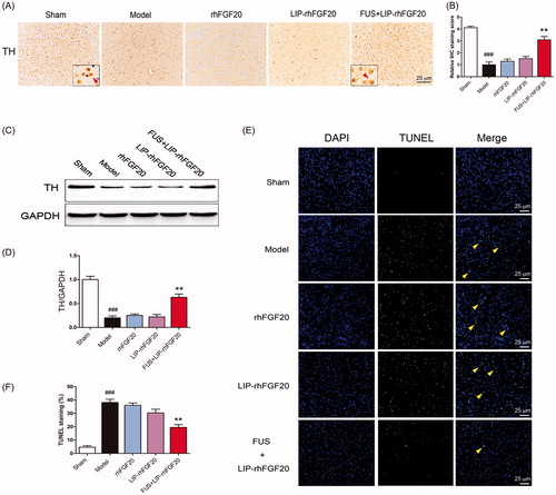 Figure 5. Impact of FUS + LIP-rhFGF20 on the dopaminergic neural loss in the striatum of 6-OHDA rats. (A) Immunohistochemistry assay using TH-antibody were carried out to detect the effects of FUS + LIP-rhFGF20, LIP-rhFGF20 and rhFGF20 on the levels of TH-positive dopaminergic neurons in SN tissues. Scale bar =25 µm. (B) Semi-quantitative analysis of TH immunohistochemistry observed in panel A. (C) Effect of FUS + LIP-rhFGF20, LIP-rhFGF20 and rhFGF20 treatment on the protein levels of TH in SN tissues. (D) Semi-quantitative analysis of the protein bands observed in panel C. (E,F) After 2 weeks’ treatment, analysis of the striatum tissue by TUNEL staining was performed to assess the effects of drugs on apoptosis. Representative pictures of the TUNEL staining (apoptotic cells are indicated by yellow arrows). Quantitative analysis of the apoptotic cells. Scale bar = 25 μm. All data in this figure from three independent measurements are presented as mean ± SEM. **p < .01 versus 6-OHDA group; ###p < .001 versus sham rats.