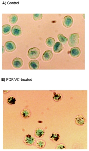 Figure 6 In situ hybridization assay. Cells were treated with the combination of PDF (150 μg/ml) and VC (200 μM) for 24 h and evaluated for apoptosis using ISH assay. A minimum of 100 cells from control and PDF/VC -treated cells were counted and assessed for staining. Over 90% (92/100) of PDF/VC -treated cells (B) were positively stained (with brown color), while >90% (93/100) of control cells (A) were negative for a stain (giving off green color).