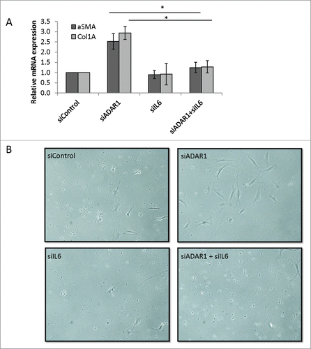 Figure 7. IL6 secreted from ADAR1 HepG2-KD cells mediates paracrine stellate cells activation. (A) Primary hepatic stellate cells were incubated with conditioned medium collected from siControl, siADAR, siIL6 or siADAR1and siIL6 co-transfected HepG2 cells. Relative mRNA expression levels of αSMA and Col1A in the HSCs were determined by qPCR analysis normalized to HPRT. Bar graphs show mean ± SEM of n = 3 experiments. (B) Representative microscopic images of the phenotypic changes of hepatic stellate cells following incubation with conditioned medium of siControl, siADAR1, siIL6, siADAR1+siIL6 transfected HepG2 cells (inverted light microscopy, x10 magnification).