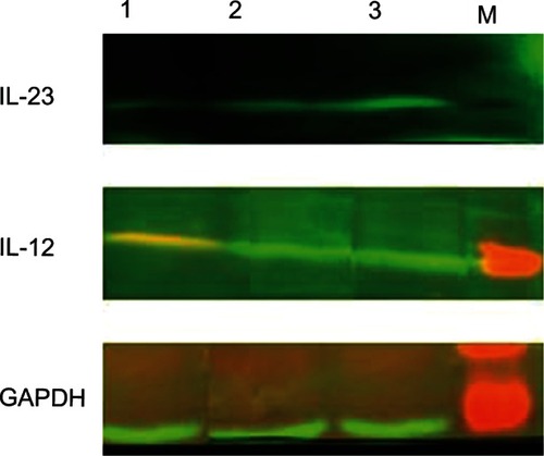Figure 6 Expression of IL-23 and IL-12 proteins on dendritic cells cultured with or without sCD40L (Western blot).