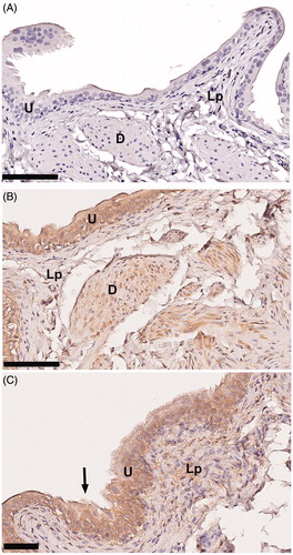 Figure 1. Representative images of the protein expression of versican in rat urinary bladder. (A) The tissue was stained without primary antibody against versican (negative control). (B and C) Application of the anti-versican antibody to the tissue resulted in immunoreactivity in the urothelium (U) and to a far lesser extent also in the detrusor muscle (D) and the lamina propria (Lp). Arrow points at microvilli-like structures at the urothelial surface. Scale bar: 100µm (A, B), 50µm (C).