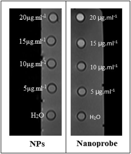 Figure 11. Obtained MRI image phantom of nanoparticles and nanoprobes.