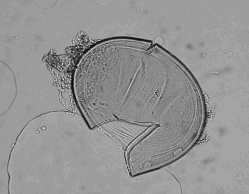 Fig. 2. Crushed spore of Scutellospora sp. showing the bulbous suspensor, the germination shield, the spore wall and an inner wall.