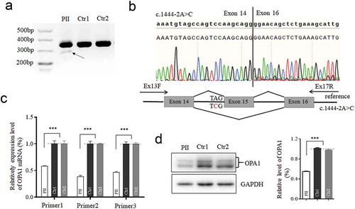 Figure 2. Effects of the splicing variant on OPA1 mRNA-transcript and its translation. The cDNA segments by reverse transcription polymerase chain reaction analyzed with the agarose gel (a), and Sanger sequencing (b). RNA extracted from the patient (PII) and other two controls (Ctr1, mother as a family control; Ctr2, genetically unrelated control subject with the same mtDNA haplotype). A schematic diagram below shows the Exon 15 skipping, caused by c.1444–2A>C. (c) The mRNA expression by three pairs of primers. segment by Primer1 encompass the exon15; segment by Primer2 is downstream the exon 15; segment by Primer3 is upstream the exon15. 50% reduction of mRNA expression was checked in the mutant cell, related to the controls. (d) Western blotting of OPA1 protein in the mutant and control cells. OPA1 protein decreased 50% in the mutant cells as comparison to the control. *, P < .05; **, P < .01; ***, P < .001