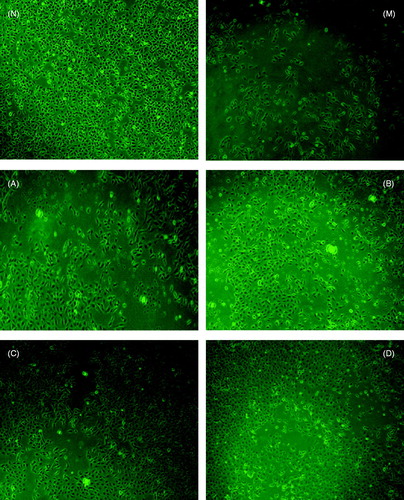 Figure 2. Morphological characterization of rat BRL 3A liver cells. Cells were treated with different concentrations of 1β-hydroxyeuscaphic acid. At the end of exposure, dichloro-Xuorescein was determined at excitation wavelength 485 nm and emission wavelength 530 nm, and the cells were visualized by inverted microscope (magnification 100×). (N) Control; (M) Model; (A) 5 μg/mL; (B) 10 μg/mL; (C) 20 μg/mL and (D) 50 μg/mL.