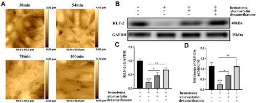 Figure 1 The expression of KLF-2 in endothelial cells was decreased after hematoma sample injury. (A) The morphological changes in cells at different time points after stimulation with hematoma supernatant observed by HPICM; (B) The changes in KLF-2 expression after treatment of hematoma supernatant-damaged cells with different interventions; (C) Gray value analysis of panel (B); (D) The changes in the KLF-2 mRNA level after treatment of hematoma-damaged cells with different interventions. *P < 0.05; **P < 0.01; ***P < 0.001.