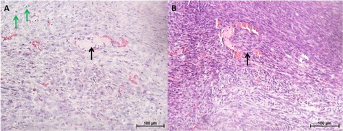 Figure 9. Histopathology of tumours and lung tissues from the mice injected with CMT-Stylo cells (Bar = 100 µm). Haematoxylin and eosin staining of harvested tumours. The tumour tissues are densely cellular. (A) Shows a tumour tissue (from a mouse injected with CMT-Stylo cells) with the arrow pointing to mitotic figures (green arrows) and a blood vessel (black arrow), (B) shows a tumour tissue with the arrow pointing at an invasion of a blood vessel by the tumour cells (from a mouse injected with CMT-Stylo cells). Bars = 100 µm.