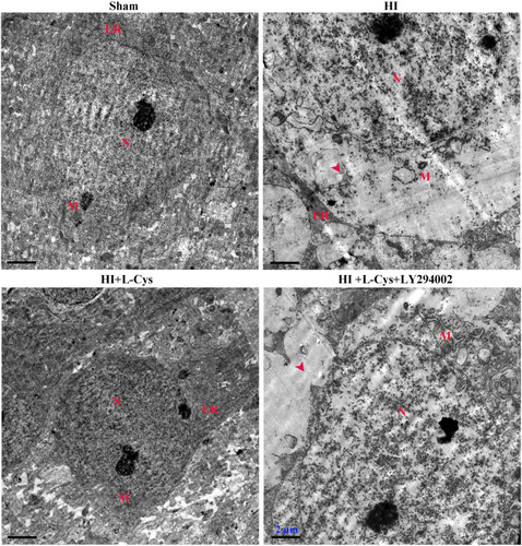 Figure 4 L-Cysteine decreases neuronal apoptosis via the Akt pathway in HI. Ultra-microstructure of neurons in the right cortex as obtained using TEM (Scale bar = 2 µm; N=4/group). Representative images demonstrated nucleus (N), mitochondria (M) and rough endoplasmic reticulum (ER). Red arrowhead indicates site of severe cytoplasmic edema.