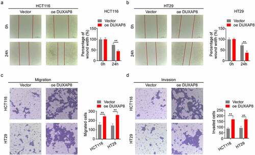 Figure 5. DUXAP8 incorporation accelerates colon cancer (CC) migration and invasion. (a-b) DUXAP8 overexpression drastically decreased the relative wound width. (c-d) DUXAP8 overexpression markedly enhanced migration and invasion versus controls. **P < 0.01.