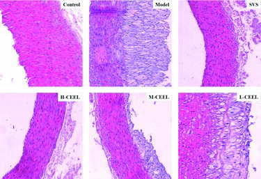 Figure 4. Effect of CEEL on the aorta histopathological changes in rabbits fed a high cholesterol diet. Representative photomicrographs of H&E staining.