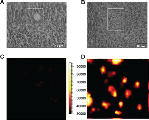 Figure S4 (A) and (B) Bright field images of a region from normal and cancerous nasopharyngeal tissue sections, respectively; (C) and (D) demonstrate surface-enhanced Raman scattering images of normal tissue and cancerous tissue, respectively. The surface-enhanced Raman scattering images were acquired by scanning the laser beam to cover the white boxes in (A) and (B) respectively.