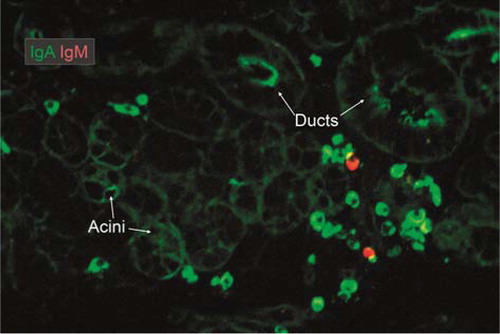 Fig. 5 Merge of paired immunofluorescence staining for IgA (green) and IgM (red) in section of saline-extracted and ethanol-fixed specimen (Citation16) of normal submandibular salivary gland. There is a dominance of IgA-producing plasma cells mainly adjacent to ducts. Note that there is a variable uptake mainly of IgA both in acini and ducts as evidenced by peripheral and some cytoplasmic staining of epithelial cells, but the luminal ring in striated duct at the middle top might represent adherent IgA from the secretion (original magnification: ×125).