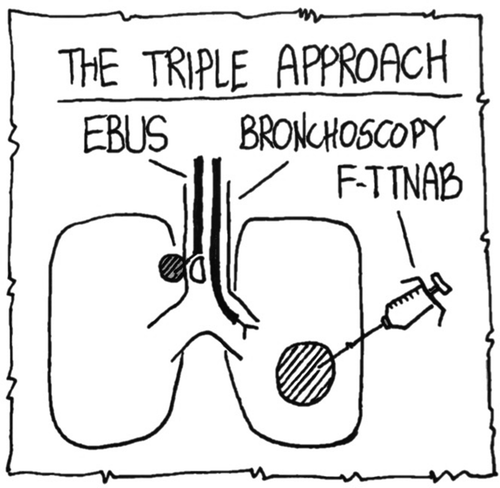 Figure 2. Schematic drawing of the principles of the triple approach. EBUS: endobronchial ultrasound, F-TTNAB: fluoroscopy-guided transthoracic fine-needle aspiration biopsy