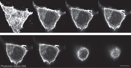 Figure 1. Breast cancer cells (BT-20) showing nuclear actin filaments stained with phalloidin Alexa 568. Representative slides of a z-stack. Scale bar 10 μm.