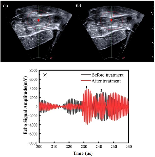 Figure 5. Comparison of sonograhy of treatment point ⑤ in the leg muscles in the #3 live goat (a) before and (b) after FUAS, and (c) the corresponding echo signals from the focal region.