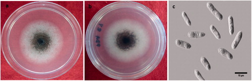 Figure 3. Cultural and morphological characteristics of C. fructicola. Culture on PDA medium (a,b), and conidia (c).