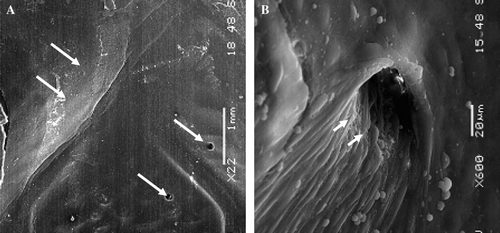 Figure 7.  Scanning electron microphotography of the proximal segment of the Module A. This stent-graft was implanted for 6 months. In the areas of contact between the stent and the host artery the struts of the stent are well incorporated (double arrows) and the flow surface is well healed with the presence of a vasa-vasorum (arrows) (A:×22) whose ostia is well defined (arrow heads) and luminal surface covered with a continuous layer of endothelial cells (B:×600).