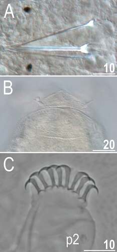 Figure 12. Detailed morphology of Echiniscoides lichenophilus sp. nov. (DIC): A. buccal apparatus, B. caudal body portion with cirri E, C. claws II and sense organ on leg II. Scale bars in μm.