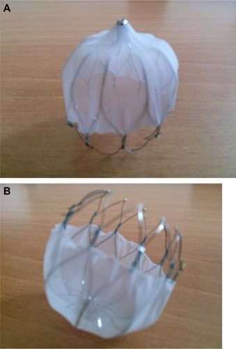 Figure 1 Watchman left atrial appendage system from above (A) and below (B).