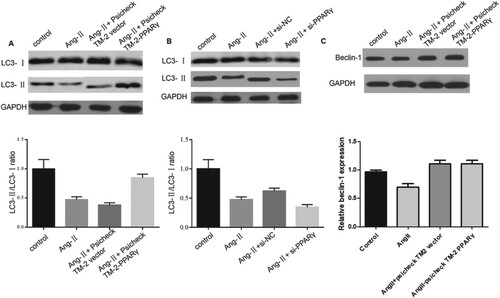 Figure 5. PPARγ inhibits CH by enhancing autophagy. (A, B, C) Levels of LC3-I/II and beclin-1 in cardiomyocytes were measured via western blotting assays in the presence of Ang-II, pCDNA-PPARγ, si-PPARγ, and corresponding negative controls.