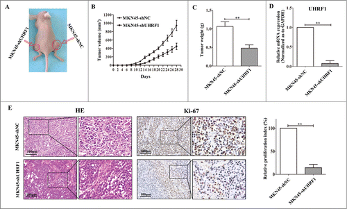 Figure 5. Down-regulation of UHRF1 inhibits GC growth in vivo. (A) MKN45-shUHRF1 and MKN45-shNC cells were injected subcutaneously into nude mice. At 4 weeks after implantation, MKN45-shUHRF1 cells produced smaller tumors than control cells. (B) Growth curve of tumor volumes. Each data point represents the mean ±SEM of 5 mice. (C) Average weight of tumors in nude mice. (D) The mRNA expression of UHRF1 in transplanted tumors formed by MKN45-shUHRF1 and MKN45-shNC cells was measured using qRT-PCR. GAPDH was used as an internal control and the fold change was calculated by 2−ΔΔCt. (E) Representative photographs of H&E staining and immunohistochemical analysis of Ki-67 antigen in tumors of nude mice (left). Comparison of proliferation index is shown on the right.