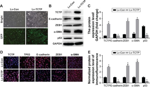 Figure 4 Ectopic overexpression of TCTP in A549 cells using lentivirus-based CMV promoter (Lv-TPT1).Notes: (A) Representative images of GFP expression in A549 cell lines in both Lv-Con group and Lv-TCTP group. (B) The levels of TPT1, E-cadherin, α-SMA, ZEB1, and p53 in the parental cell lines and overexpression of TCTP in A549 cell lines were examined by Western blot. (C) Bar graph of the expression levels of the proteins in (B). (D) The levels of TPT11, E-cadherin, α-SMA, ZEB1, and p53 in the parental cell lines and TPT1 overexpression in A549 cell lines were examined by confocal laser microscopy. (E) Bar graph of the expression levels of the proteins in (D). *P<0.01.