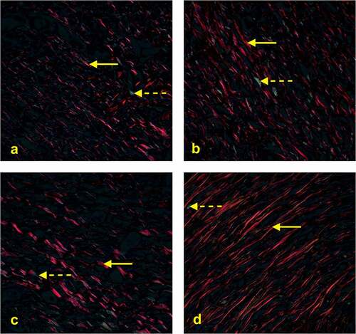 Figure 4. Photomicrography showing the area of collagen type I and III (400x). Picrossirius Red stains type I collagen in red and type III collagen in green, indicated by the solid yellow and dotted arrows, respectively. Analysis of captured images the polarized light microscope showed a predominance of collagen type I (mature) in all groups at the end of the experiments (28th day).