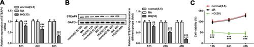 Figure 1 The expression of STEAP4 in HG-induced HRCECs gradually decreased. The expression of STEAP4 was detected by RT-qPCR (A) and Western blot (B), n=3. (C) CCK-8 assay was used to detect the cell viability, n=5, **p<0.01, ***p<0.001 vs normal; ##p<0.01, ###p<0.001 vsMA.