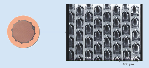 Figure 1. Adhesive Dermally-Applied Microarray (ADAM) with zolmitriptan-coated titanium microprojections.Left panel depicts the assembled ADAM. Right shows a scanning electron micrograph of the zolmitriptan-coated microprojections.