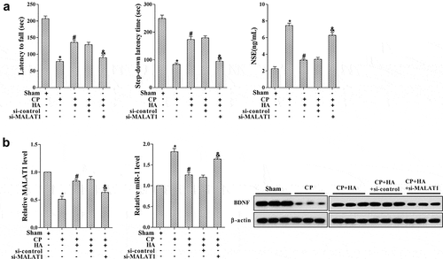 Figure 6. Down-regulation of MALAT1 abolished the neuroprotective effect of HA-introduced vitamin B1 and B12 in cerebral palsy rats. Rats were randomly allocated into several groups (n = 6 in each group): Sham, CP, CP+HA-VitB, CP+HA+si-control, and CP+HA+si-MALAT1. (a) The motor and memory functions of rats were evaluated by Rota-rod test and Step-down avoidance task, respectively; the NSE level was detected by ELISA. (b) The expression of MALAT1, miR-1, and BDNF mRNA in hippocampus tissues was quantified with qRT-PCR; the level of BDNF protein in hippocampus tissues was analyzed by western blot. *P < 0.05 compared with sham; #P < 0.05 compared with CP.