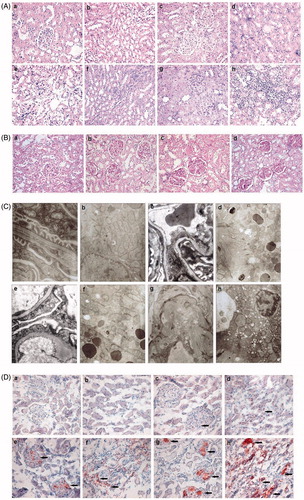 Figure 2. Pathological changes in renal tissue. (A) HE staining of the glomeruli and tubules in Group N (a and b), HF (c and d), ADR (e and f), ADR + HF (g and h), (400×). (B) PAS staining of the glomeruli in Group N (a), HF (b), ADR (c), ADR + HF (d), (400×). (C) The ultrastructure of the glomeruli and tubules detected by electron microscopy, in Group N (a and b), HF (c and d), ADR (e and f), ADR + HF (g and h) (Glomeruli EM 14,000×, Renal tubules EM 7000×). (D) Sudan III staining of glomeruli and tubules in Group N (a and b), HF (c and d), ADR (e and f), ADR + HF (g and h), (400×). Immunocytochemistry showed no fat expression in the kidneys of Group N, little fat expression in the tubular epithelium of Group HF, more fat expression in the epithelium of glomeruli and renal tubules in Group ADR, Strong fat expression in glomeruli and renal tubules in Group ADR + HF (arrowheads).